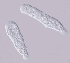 ciclo de vida de la acanthamoeba