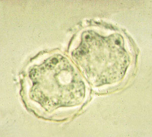 trofozoíto naegleria fowleri